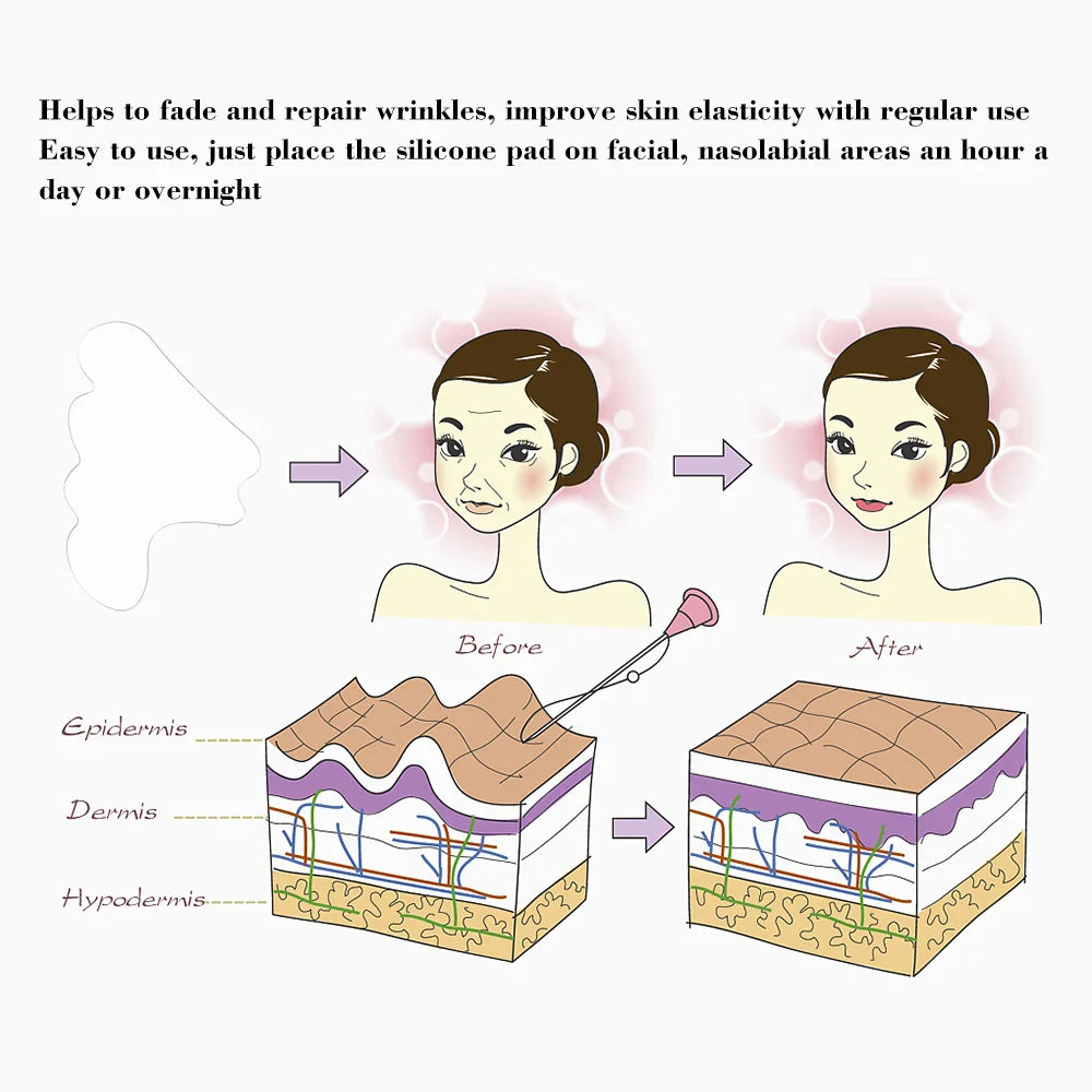Gesichtsfaltenentferner Pad Wiederverwendbar Medizinisches Silikon Nasolabialfalten Anti-Aging Maske Verhindern Falten Haut Lifting Patches