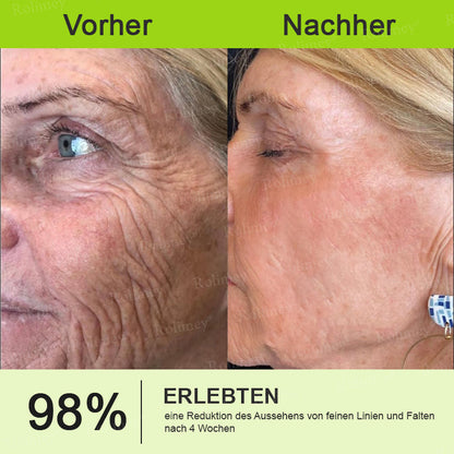 💫💫🍀Jetzt jugendliche Haut zurückgewinnen 💫Rolimey® Botox & Vita-A Retinol Shot Falten-Lift Straffungscreme👩‍🔬LETZTER TAG – 70 % RABATT