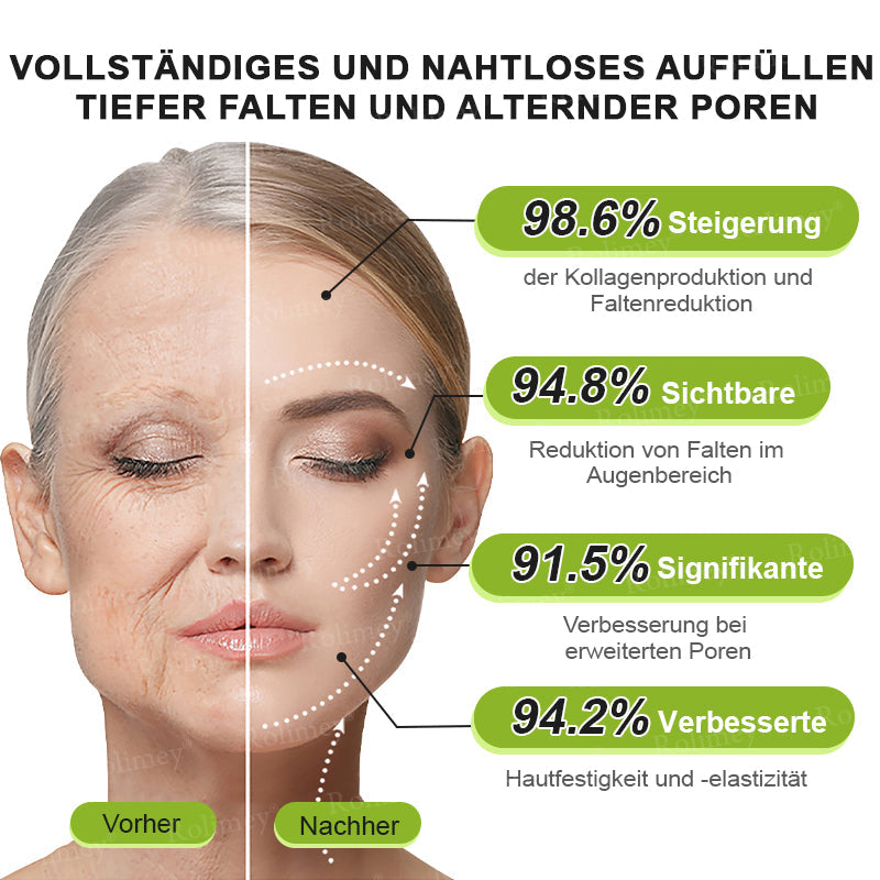 💫💫🍀Jetzt jugendliche Haut zurückgewinnen 💫Rolimey® Botox & Vita-A Retinol Shot Falten-Lift Straffungscreme👩‍🔬LETZTER TAG – 70 % RABATT