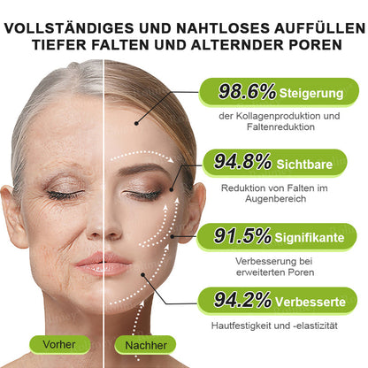 💫💫🍀Jetzt jugendliche Haut zurückgewinnen 💫Rolimey® Botox & Vita-A Retinol Shot Falten-Lift Straffungscreme👩‍🔬LETZTER TAG – 70 % RABATT