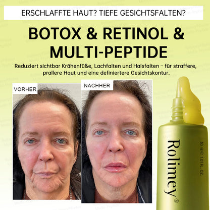 💧🍃🌟Rolimey® Multi-Peptid Retinol Shot Anti-Aging Faltenlifting-Creme
