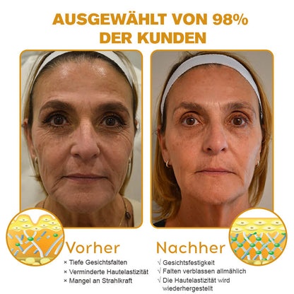(🌿Hergestellt und versandt aus Deutschland✅)✨Furzero™ Botox Bienengift Falten- und Fleckencreme Pro