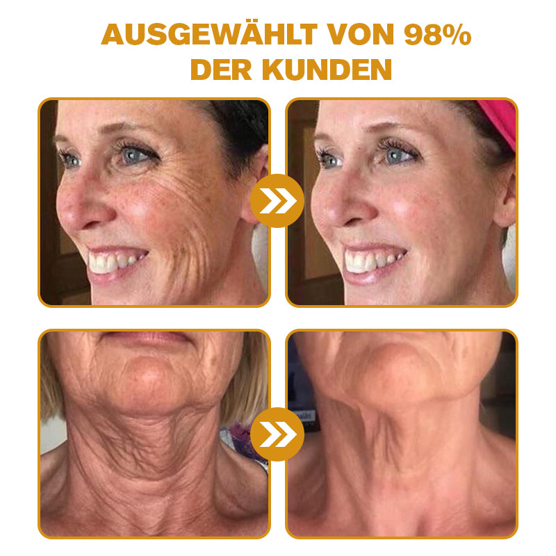 (🌿Hergestellt und versandt aus Deutschland✅)✨Furzero™ Botox Bienengift Falten- und Fleckencreme Pro