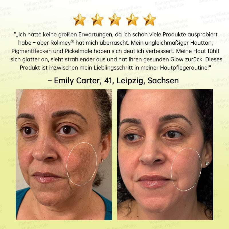 💧🍃🌟Rolimey® Multi-Peptid Retinol Shot Anti-Aging Faltenlifting-Creme