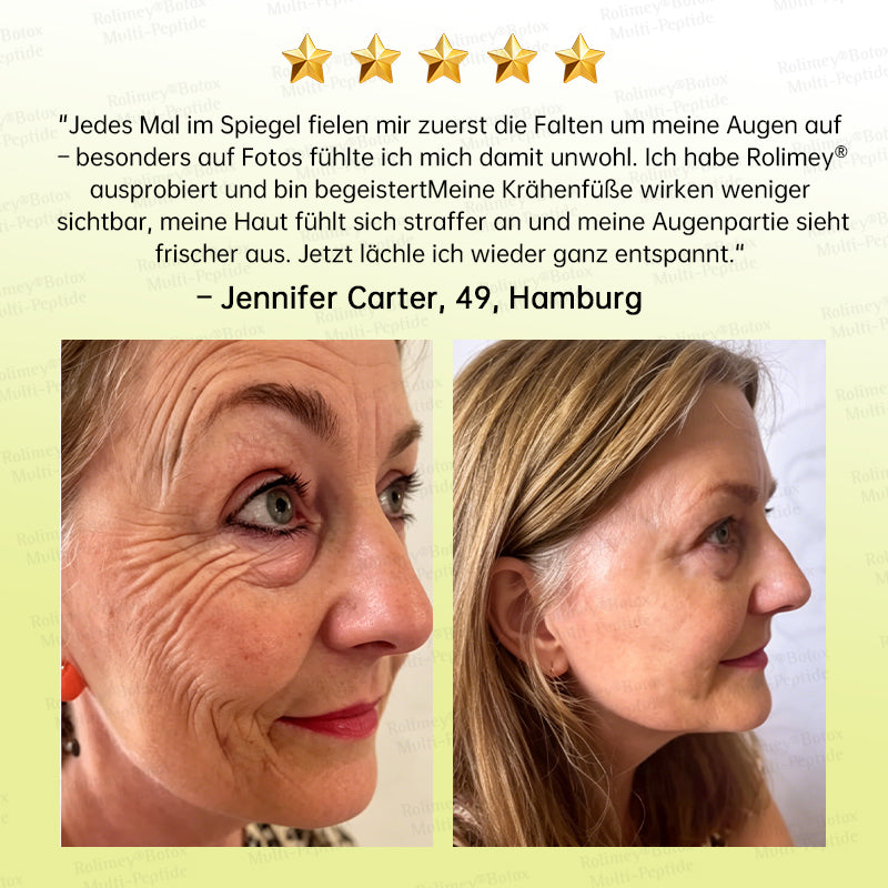 💧🍃🌟Rolimey® Multi-Peptid Retinol Shot Anti-Aging Faltenlifting-Creme