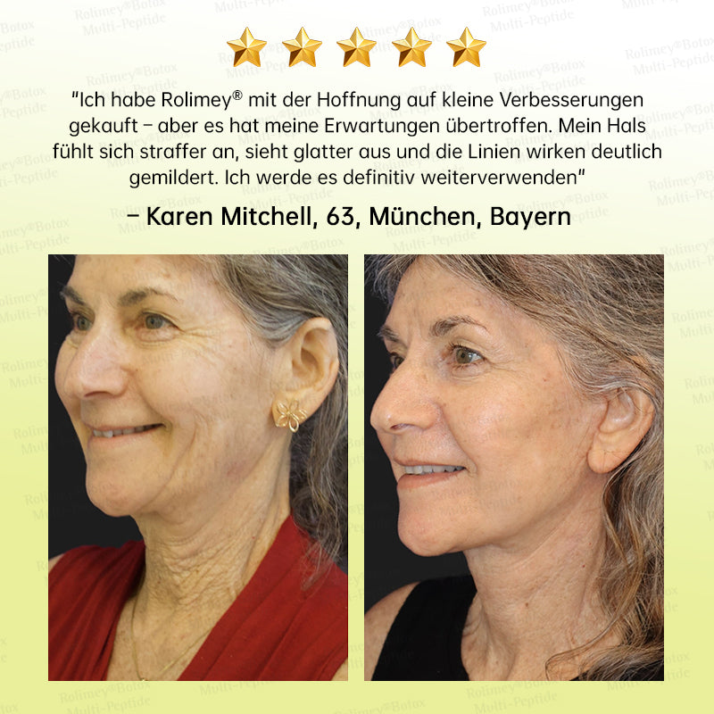 💧🍃🌟Rolimey® Multi-Peptid Retinol Shot Anti-Aging Faltenlifting-Creme