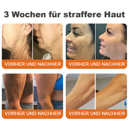 🍀🍀🍀✨Hergestellt in Deutschland✨Flysmus™ Botox-Bienenvergiftungsstraffungsserum-Stick🔥LETZTER TAG 70% RABATT