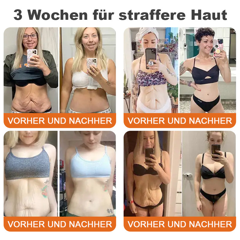 🍀🍀🍀✨Hergestellt in Deutschland✨Flysmus™ Botox-Bienenvergiftungsstraffungsserum-Stick🔥LETZTER TAG 70% RABATT