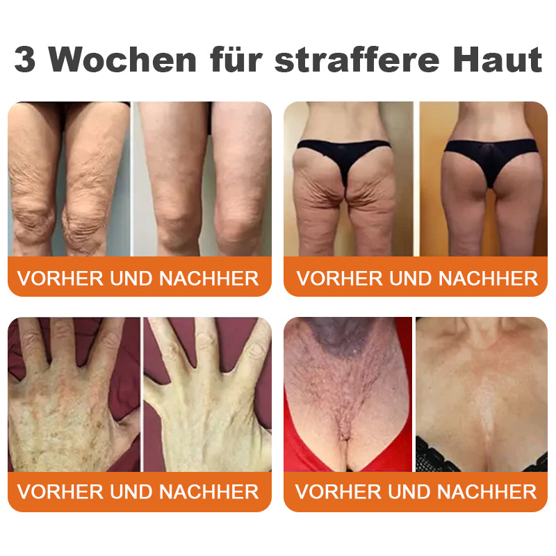 🍀🍀🍀✨Hergestellt in Deutschland✨Flysmus™ Botox-Bienenvergiftungsstraffungsserum-Stick🔥LETZTER TAG 70% RABATT