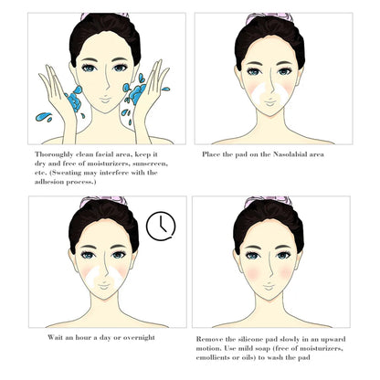 Gesichtsfaltenentferner Pad Wiederverwendbar Medizinisches Silikon Nasolabialfalten Anti-Aging Maske Verhindern Falten Haut Lifting Patches