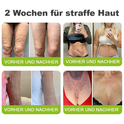 💫💫🍀Jetzt jugendliche Haut zurückgewinnen 💫Rolimey® Botox & Vita-A Retinol Shot Falten-Lift Straffungscreme👩‍🔬LETZTER TAG – 70 % RABATT